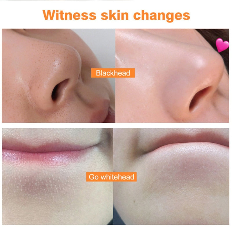 Máscara facial hidratante com vitamina C